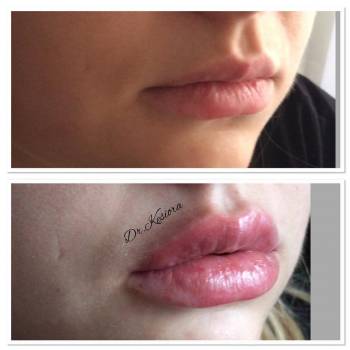 Фото с портфолио Алена Кесиора 