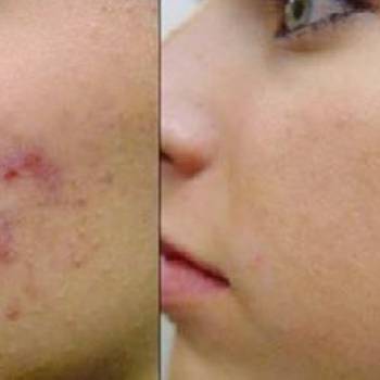 Фото с портфолио Екатерина Сляднева 