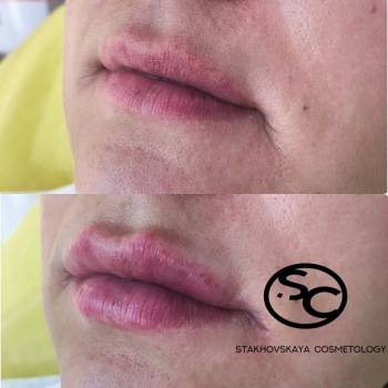 Стаховская Марина , Днепр Фото - 6