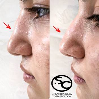 Стаховская Марина , Днепр Фото - 8