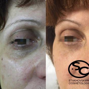 Стаховская Марина , Днепр Фото - 11