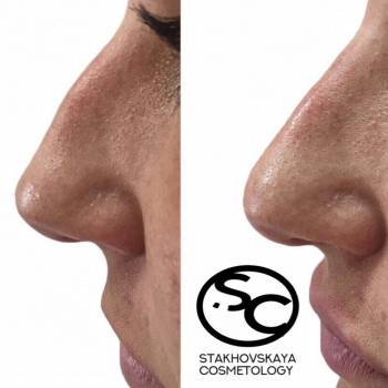 Стаховская Марина , Днепр Фото - 12