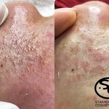 Стаховская Марина , Днепр Фото - 15