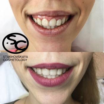 Стаховская Марина , Днепр Фото - 16