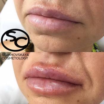 Стаховская Марина , Днепр Фото - 18