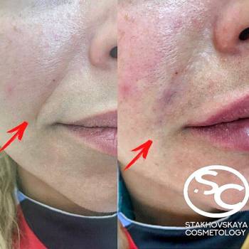 Стаховская Марина , Днепр Фото - 19