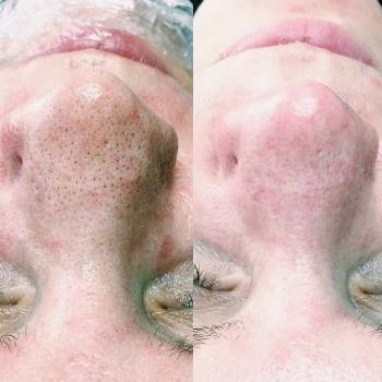 Инна Гук , Днепр Фото - 9