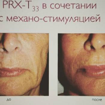 Perfect, Харків Фото - 38