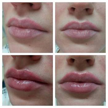 Perfect, Харків Фото - 42