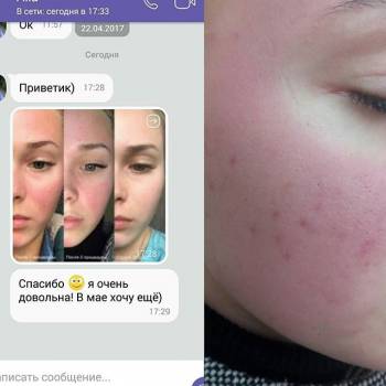 Perfect, Харків Фото - 52