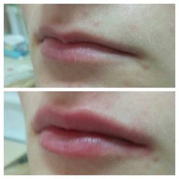 Perfect, Харків Фото - 53