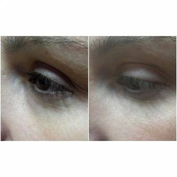 Perfect, Харків Фото - 61