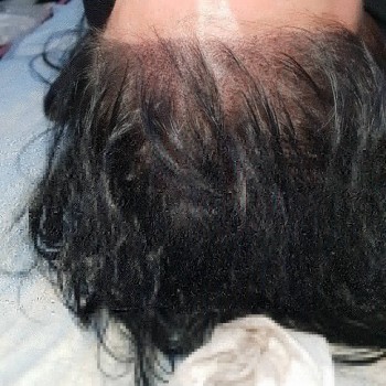 Трихопигментация 
                    Студия татуажа Студия татуажа Виктории Громовой Харьков