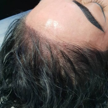 Трихопигментация 
                    Студия татуажа Студия татуажа Виктории Громовой Харьков