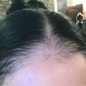 Трихопигментация 
                    Студия татуажа Студия татуажа Виктории Громовой Харьков