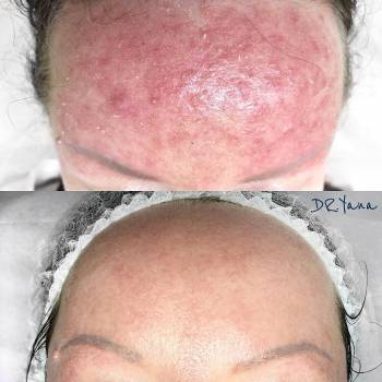 Яна Ткач , Дніпро Фото - 5