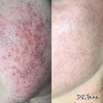 Яна Ткач , Дніпро Фото - 7