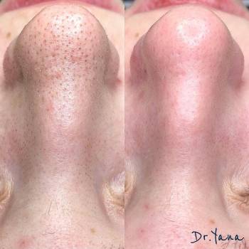 Яна Ткач , Дніпро Фото - 8