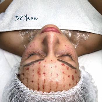 Яна Ткач , Дніпро Фото - 9