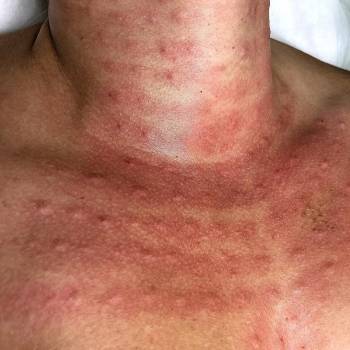 Яна Ткач , Дніпро Фото - 10