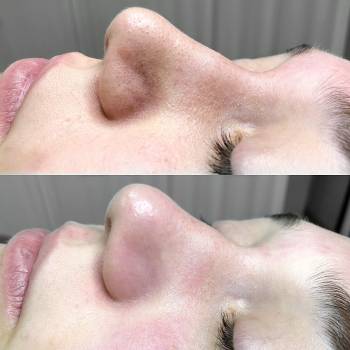 Яна Ткач , Дніпро Фото - 13