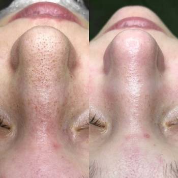 Яна Ткач , Дніпро Фото - 14