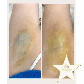 Ирина Кравчук , Київ Фото - 6