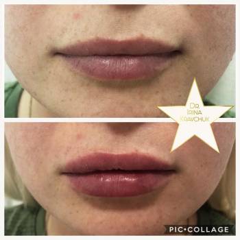 Ирина Кравчук , Київ Фото - 13