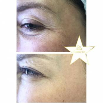 Ирина Кравчук , Київ Фото - 19