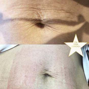 Ирина Кравчук , Київ Фото - 22