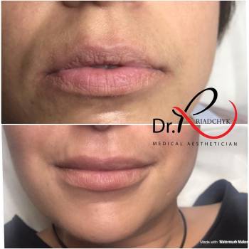 Татьяна Рядчик, Киев Фото - 8