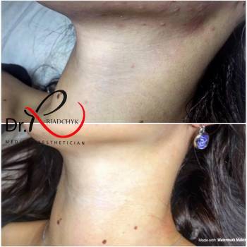 Татьяна Рядчик, Киев Фото - 9