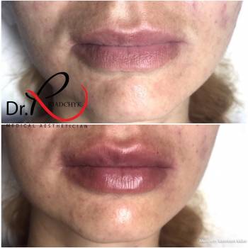 Татьяна Рядчик, Киев Фото - 11