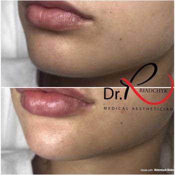 Татьяна Рядчик, Киев Фото - 12