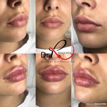 Татьяна Рядчик, Киев Фото - 13