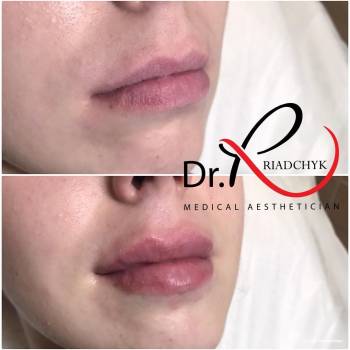 Татьяна Рядчик, Киев Фото - 14