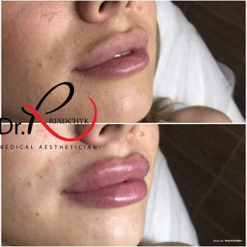 Татьяна Рядчик, Киев Фото - 16