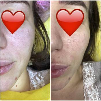 Татьяна Рядчик, Киев Фото - 17