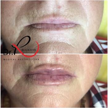 Татьяна Рядчик, Киев Фото - 18