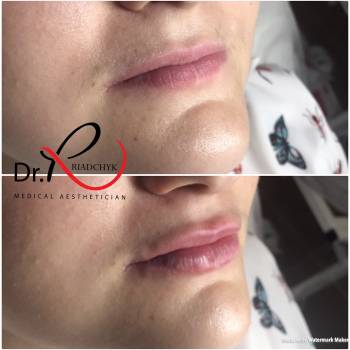 Татьяна Рядчик, Киев Фото - 21