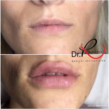 Татьяна Рядчик, Киев Фото - 22