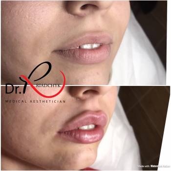 Татьяна Рядчик, Киев Фото - 24