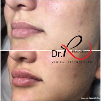 Татьяна Рядчик, Киев Фото - 26