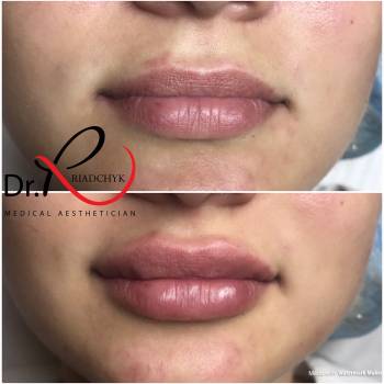 Татьяна Рядчик, Киев Фото - 27