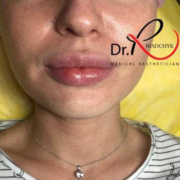 Татьяна Рядчик, Киев Фото - 28