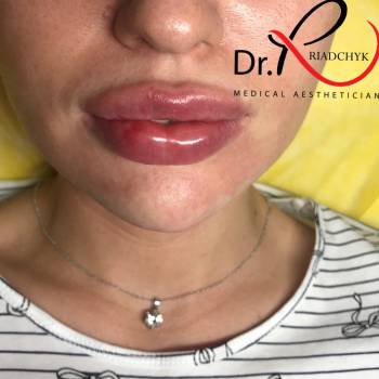 Татьяна Рядчик, Киев Фото - 29