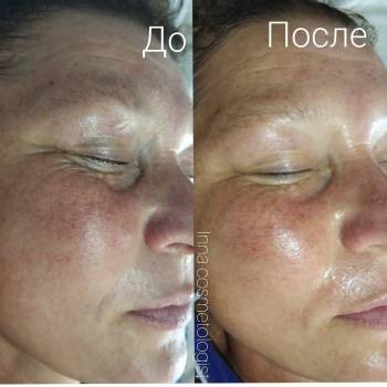 Инна , Київ Фото - 15