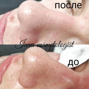 Инна , Київ Фото - 16