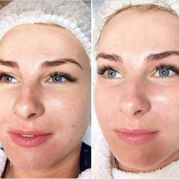 Инна , Київ Фото - 17