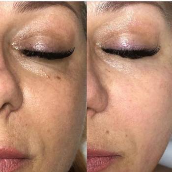 Инна , Київ Фото - 27